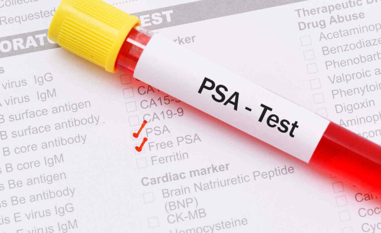 nuevo análisis de sangre detecta tumores