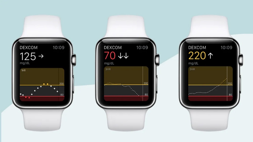 Dexcom tiene todo: reloj inteligente y medición de azúcar en sangre